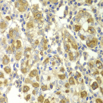 TNF-α Polyclonal Antibody[2908