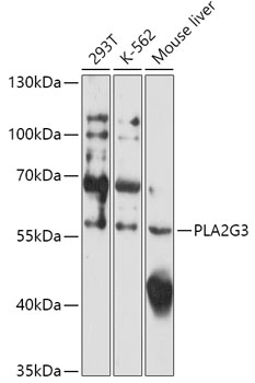 PLA2G3 Polyclonal Antibody[301