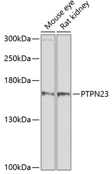 PTPN23 Polyclonal Antibody[305