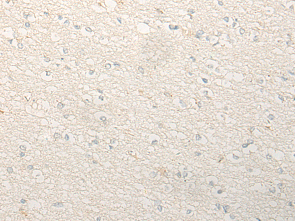 DZIP1 Antibody[47088]