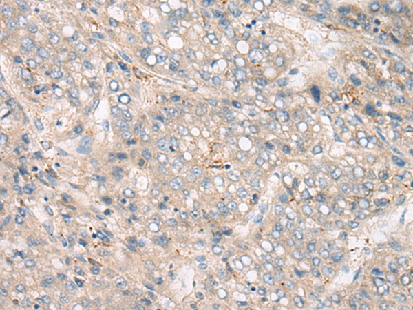 CAPN14 Antibody[46398]
