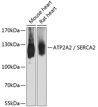 ATP2A2 / SERCA2 Polyclonal Ant