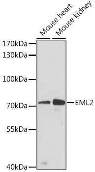 EML2 Polyclonal Antibody[30587