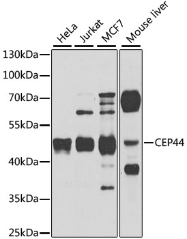 CEP44 Polyclonal Antibody[3150