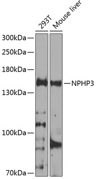 NPHP3 Polyclonal Antibody[3160