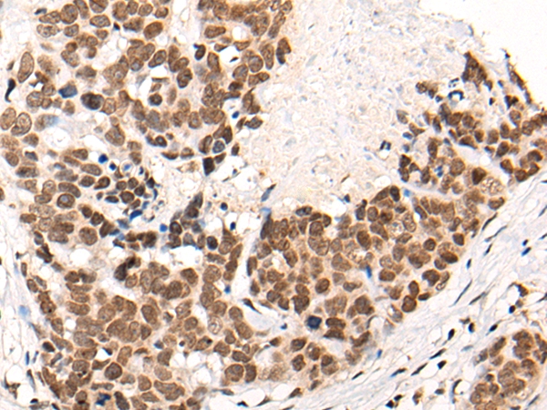 CACNA1H Antibody[46383]