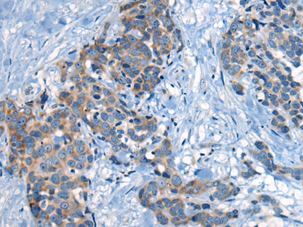 CLPX Antibody[46518]