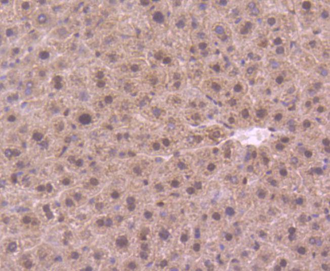 DYNLL1 Rabbit mAb[49177]