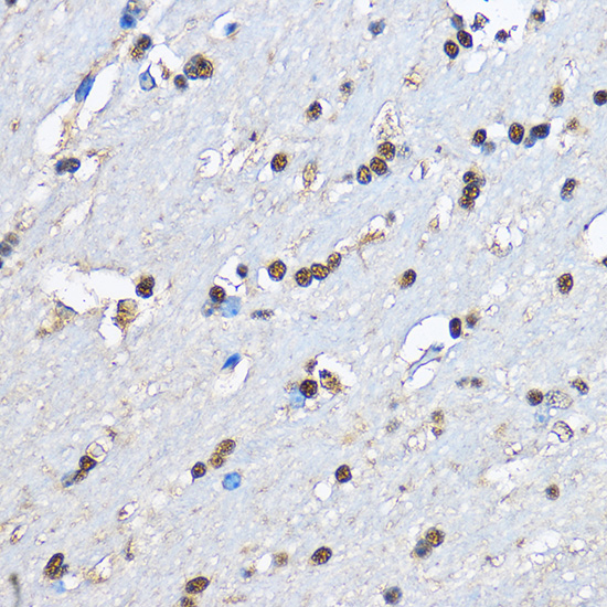 EGLN1 Polyclonal Antibody[2862