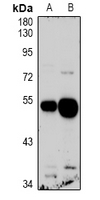 GPR103 Antibody[47988]