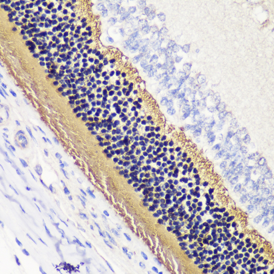 PDC Polyclonal Antibody[28666]