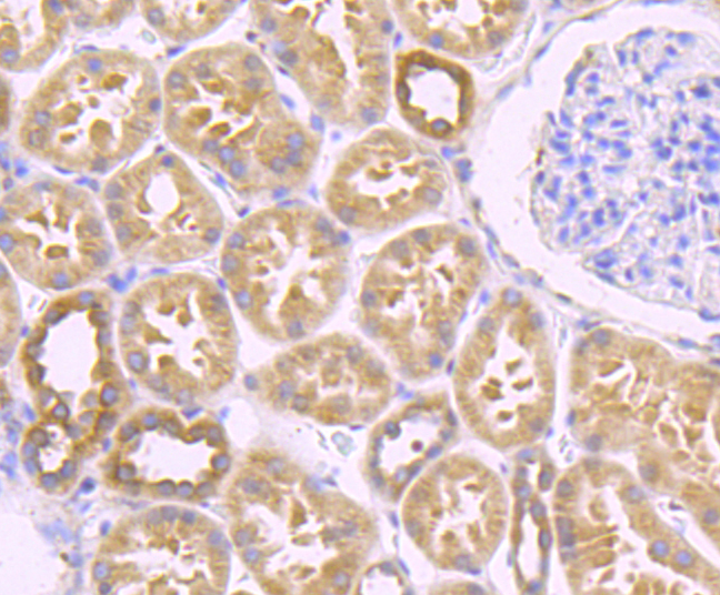 Zyxin Rabbit mAb[49705]