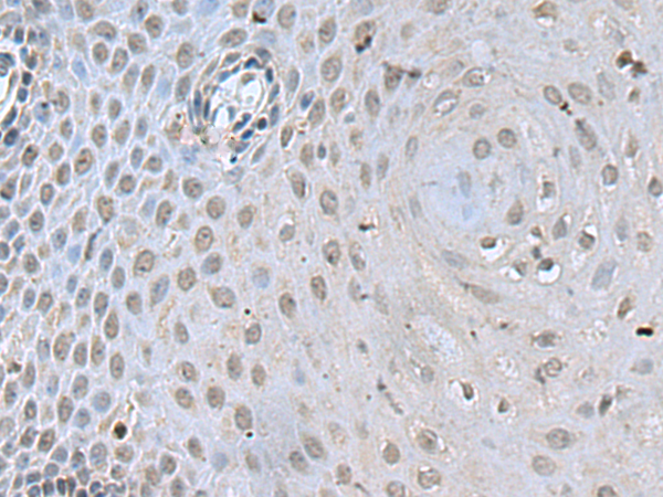DCPS antibody[31840]