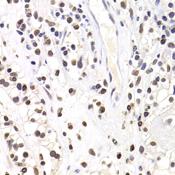 SOX5 Polyclonal Antibody[30782