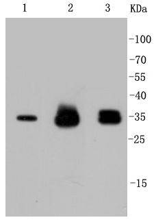 Cyclin D1 Rabbit mAb[48619]