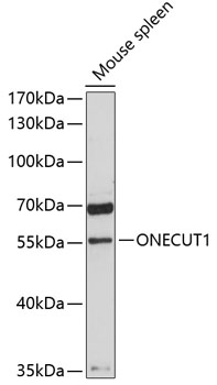ONECUT1 Polyclonal Antibody[31