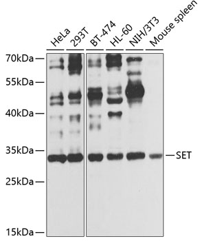 SET Polyclonal Antibody[29117]