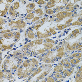 PTK7 Polyclonal Antibody[31752