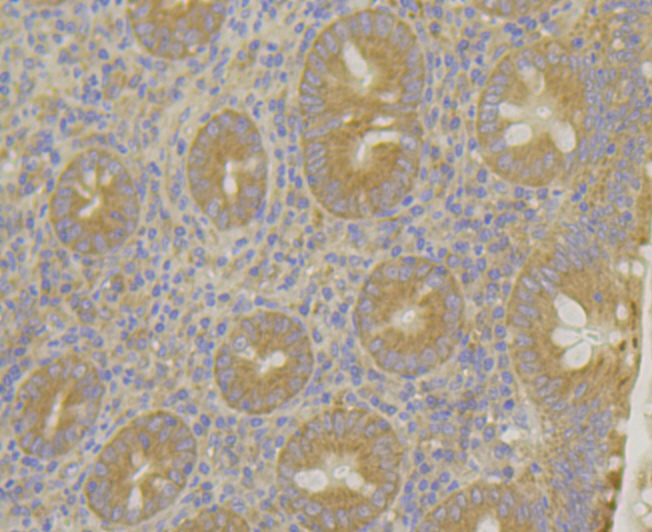 MARK2 Rabbit mAb[49983]