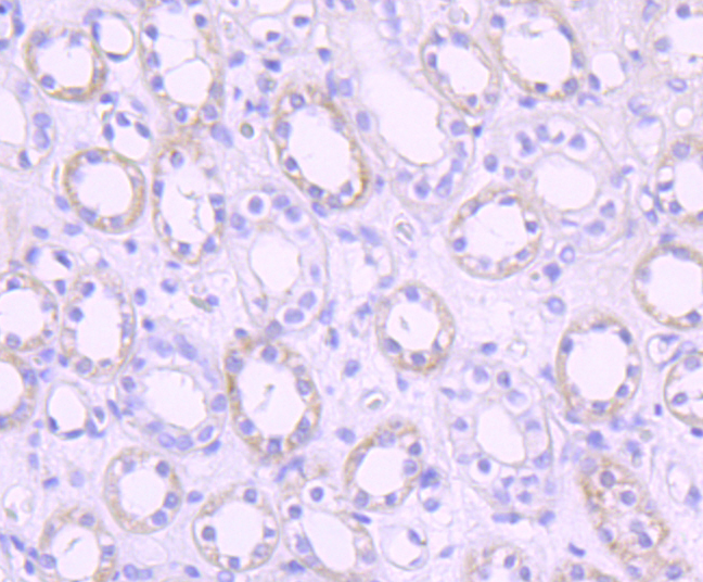 PDK1 Rabbit mAb[49573]