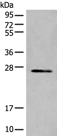 TIMM21 Antibody[46685]