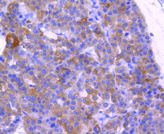 ABCF1 Rabbit mAb[49078]