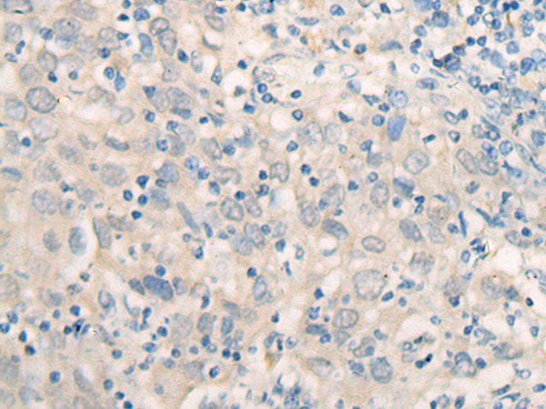 FSD1 Antibody[47123]