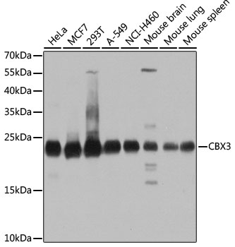 CBX3 Polyclonal Antibody[30413