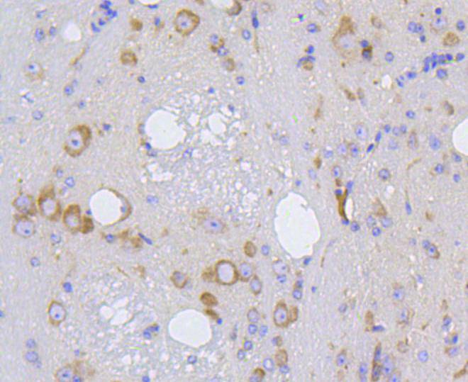 IRF1 Rabbit mAb[48646]