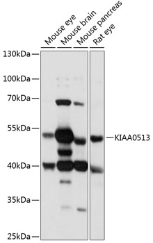 KIAA0513 Polyclonal Antibody[2