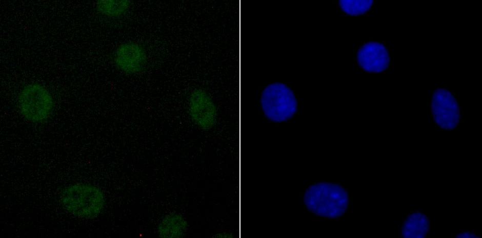 DDX5 Rabbit mAb[49625]