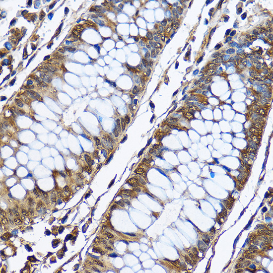 EGLN1 Polyclonal Antibody[2862