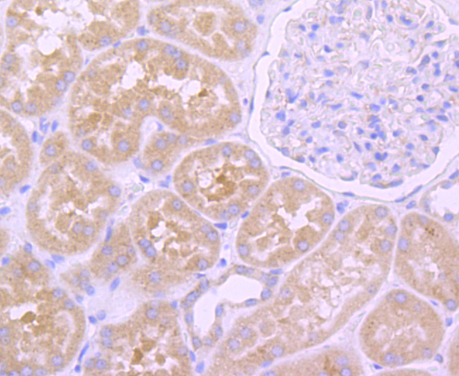 EGFR Rabbit mAb[48691]