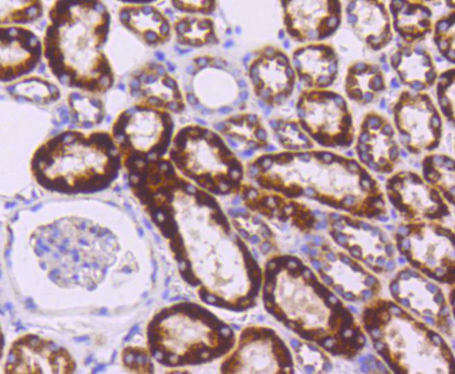 Sonic Hedgehog Protein/SHH(C-P