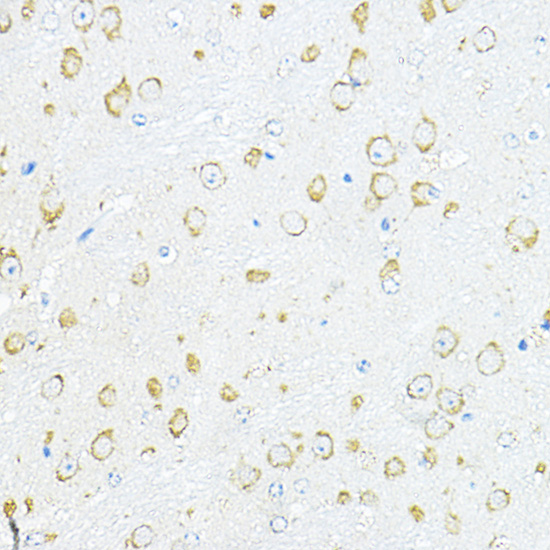 RPL10A Polyclonal Antibody[306