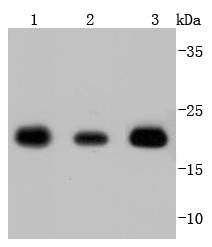 SOD2 Rabbit mAb[49265]