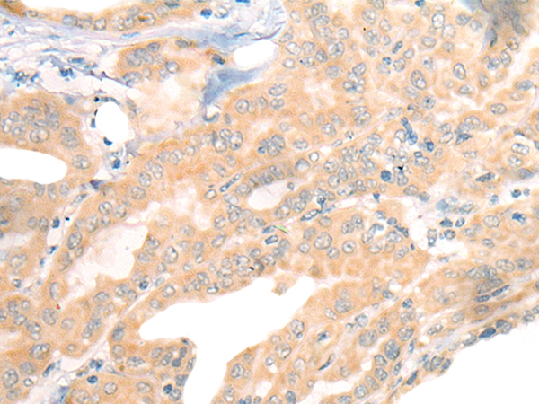 CEP290 Antibody[46475]