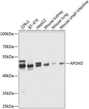 AP1M2 Polyclonal Antibody[3151