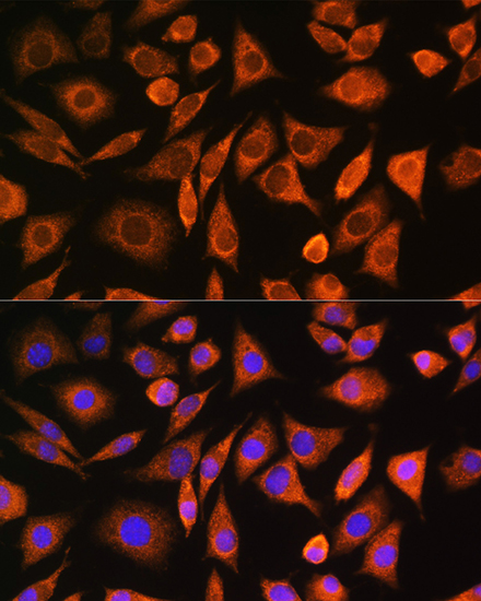 CNOT1 Polyclonal Antibody[3068