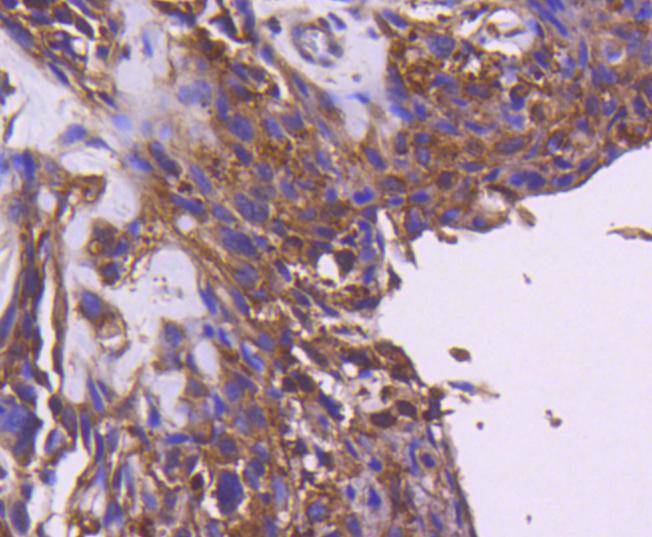 IRS1 Rabbit mAb[49156]