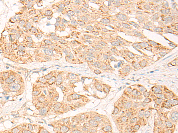 COG2 Antibody[46965]