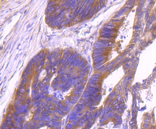 Id1 Rabbit mAb[49637]