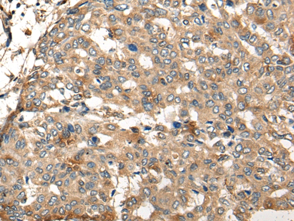 ADRA2A Antibody[46306]