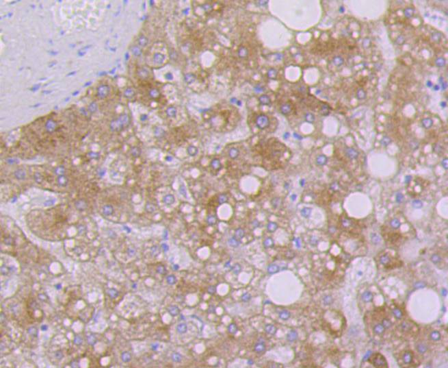 Cytokeratin 7 Rabbit mAb[48899