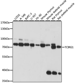 TCIRG1 Polyclonal Antibody[289