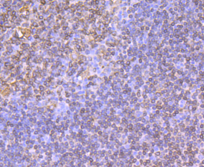 CD74 Rabbit mAb[49365]