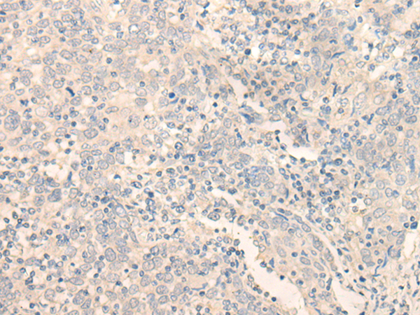 ERP27 Antibody[47112]
