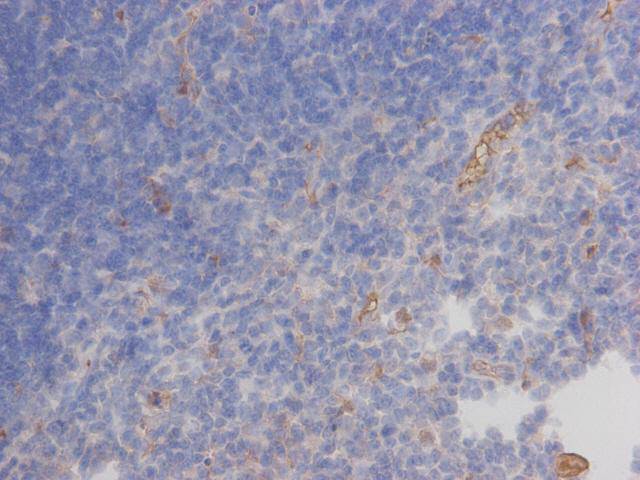 Autoimmune regulator Antibody[