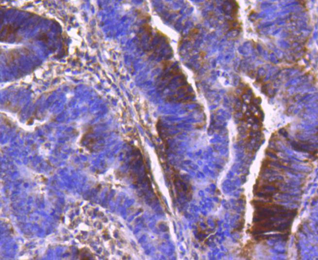PDPK1 Rabbit mAb[49136]