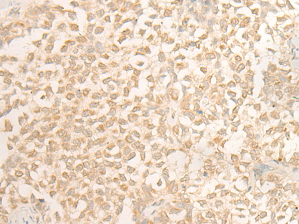 DUSP27 Antibody[47083]